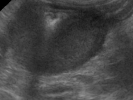 Colonic mast cell tumour in a cat