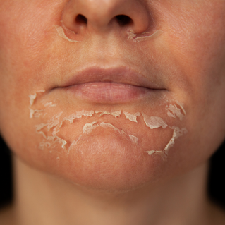 3 Reasons Why Your Chemical Isn’t Working