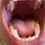 Thumbnail: Lucas's Big Mouth & Tongue