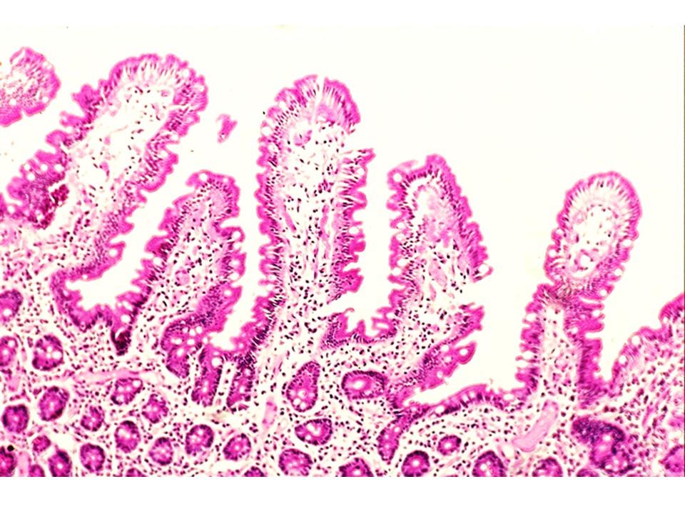 A Histology Tour Of The Gi Tract The Duodenum A Histology Tour Of The Gi Tract The Duodenum