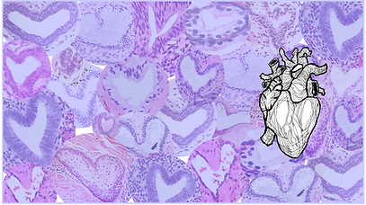 anatomical heart bckgd purple_edited.png