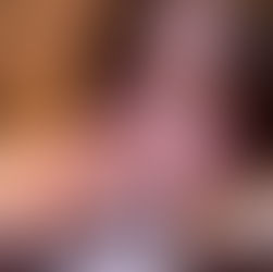 硬直した筋肉と心の鎧