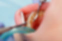 scalplaning-Aug2019-920x613.jpg