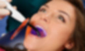 Curing Light.jpeg