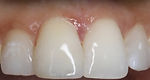 RCT After Photo.jpeg