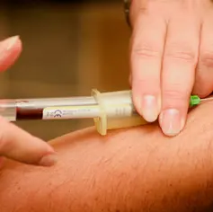 Blood Transfusion for Pediatric Patients with Sickle Cell Disease