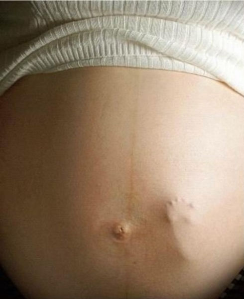 Pregnant belly -baby foot.jpg