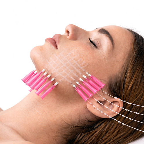 HILOS TENSORES.jpg.jpeg