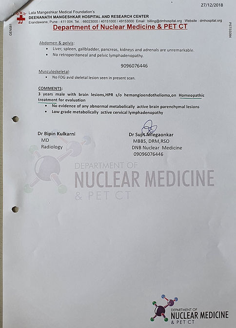 Hemangioendothelioma mri