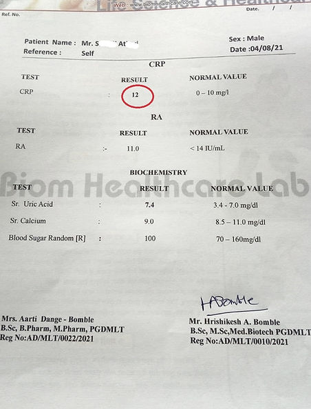 crp test