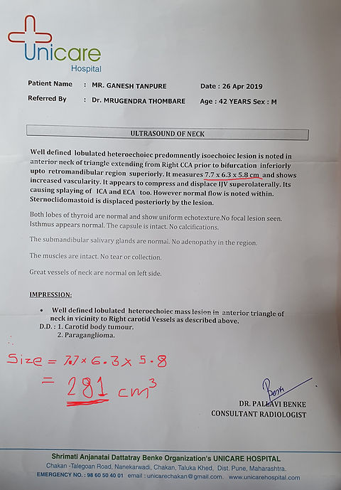 carotid body tumour report