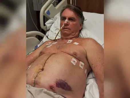 Na Páscoa, Bolsonaro agradece apoio e atualiza estado de saúde
