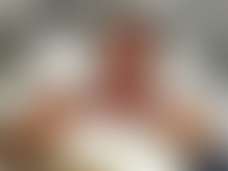 Bolsonaro apresenta melhora e é transferido para o quarto