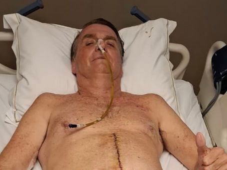 Jair Bolsonaro mostra cicatriz e hematomas após uma semana de cirurgia