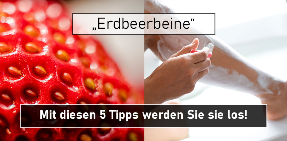 Was Kann Ich Gegen Erdbeerbeine Tun Erdbeerbeine: Die 5 besten Tipps dagegen!