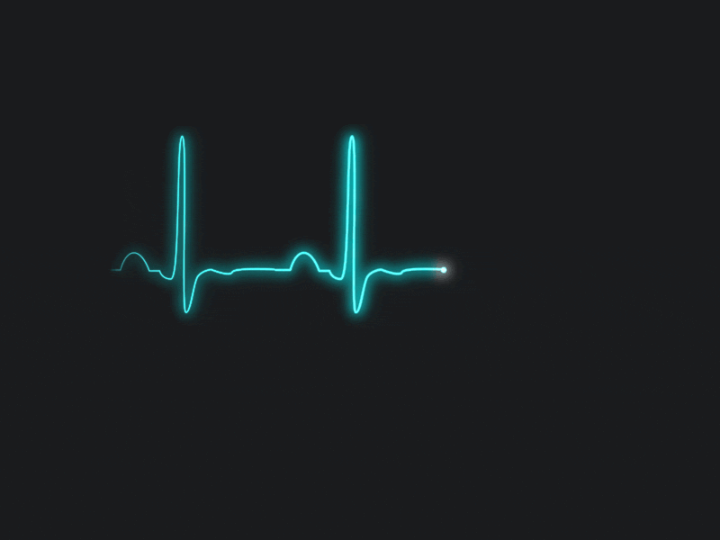 ekg