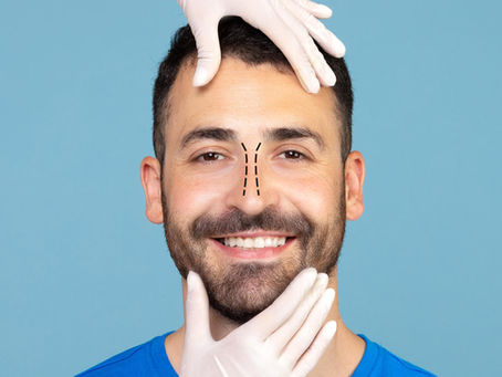 Enxertos na Rinoplastia em Campinas