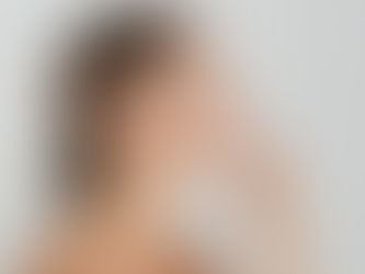 Rinoplastia com PRF em Campinas