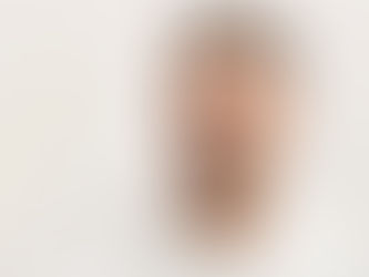 rinoplastia preservadora em Campinas