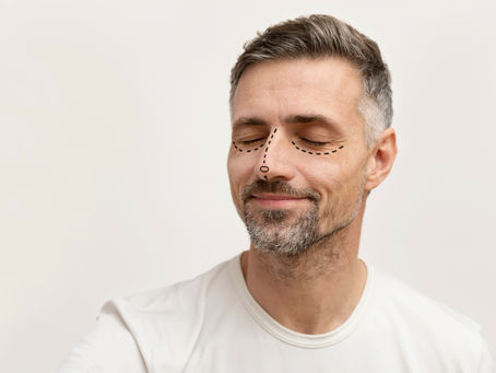 rinoplastia preservadora em Campinas