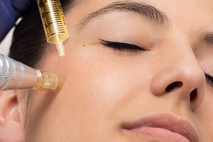 Haute Contour Bonn Microneedling Medical Needling