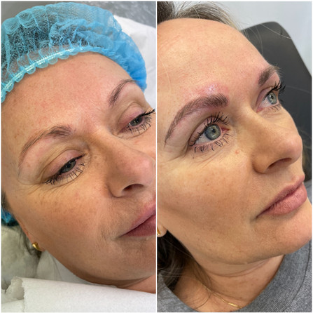 Semi-Permanent Brows
