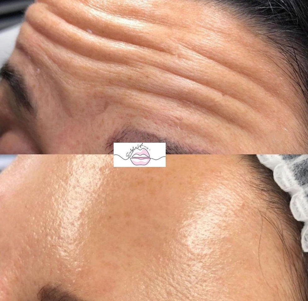 ANTI-WRINKLE