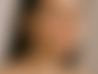 Acne depois dos 25? Entenda por que acontece e como tratar com respeito à sua pele