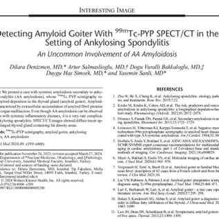 Détection du goitre amyloïde avec 99m Tc-PYP SPECT/CT dans le cadre de la spondylarthrite ankylosante : une atteinte peu fréquente de l'amylose AA