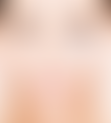 HOW TO BEST CARE FOR THE FRAGILE EYE CONTOUR AREA?