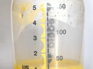 COLOSTRUL: De ce este atât de important și ce rol au "spațiile" dintre celulele sânului