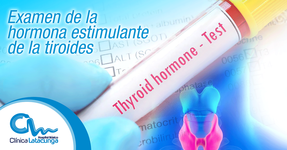 Examen de la hormona estimulante de la tiroides