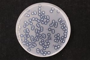 Imagine a Plastic Free World - Fungi is making this a reality.