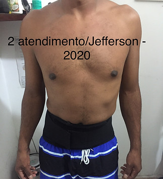2° atendi jeferson 2020