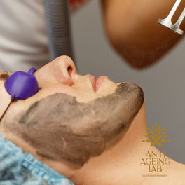 Carbon peeling vs Chemical peeling
