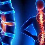 Spine Disorder