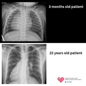 Two Hearts on the Right Side