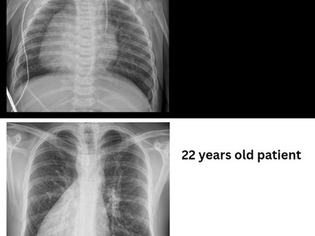 Two Hearts on the Right Side