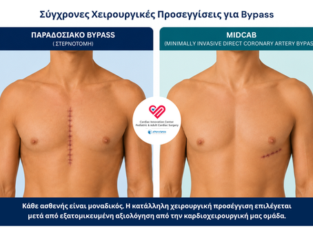 This illustration compares the traditional sternotomy approach with the minimally invasive MIDCAB technique. The image provides an approximate representation of the size and location of the surgical incision for each approach, highlighting the smaller incision used in the MIDCAB technique.