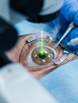 Laser_eye_surgery_procedure_2K_202609011133.jpeg