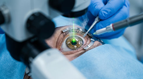 Laser_eye_surgery_procedure_2K_202609011133.jpeg