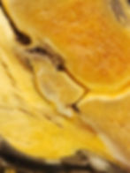Thumbnail: Desktop sagittal with navicular changes 