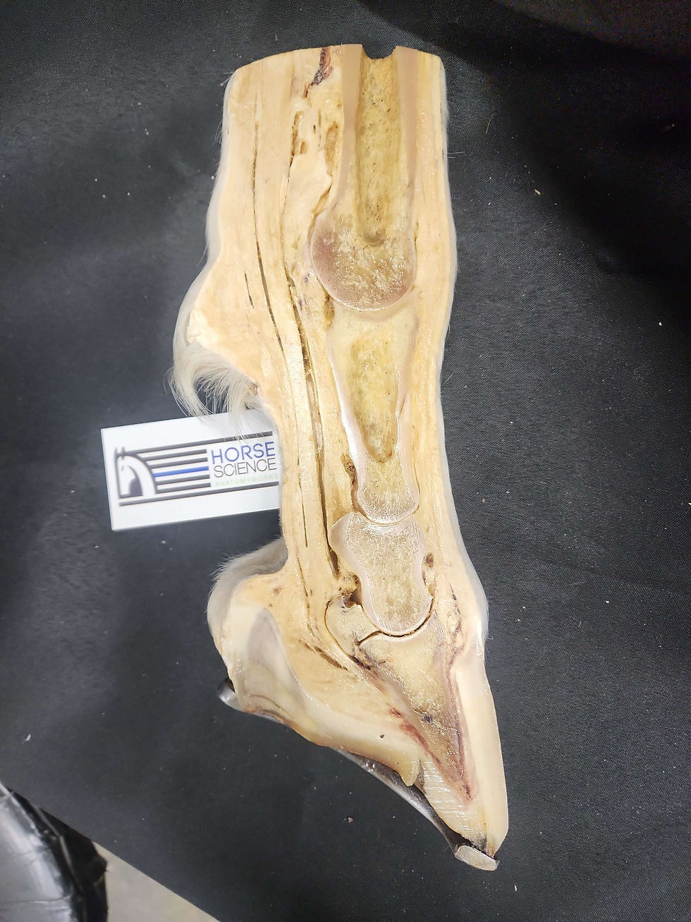 Thumbnail: Sagittal navicular