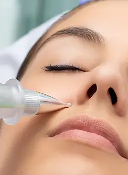 Macro detail of cone shaped plasma pen reducing wrinkles around cheek on young woman_ Noni