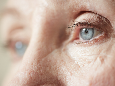What Causes Glassy Eyes in Older Adults