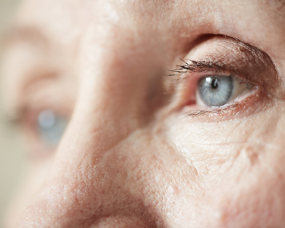 What Causes Glassy Eyes in Older Adults