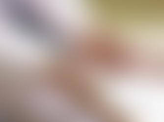 Stroke Prevention: How to Reduce the Risk of a Second Stroke 