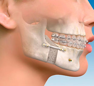 cirugÃa maxilofacial.jpg