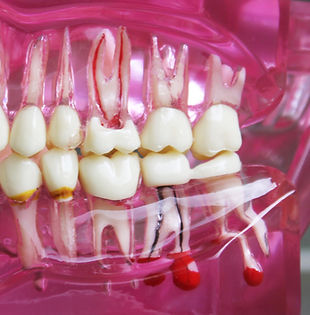 endodoncia_edited.jpg