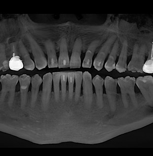 Periodoncia_edited_edited.jpg